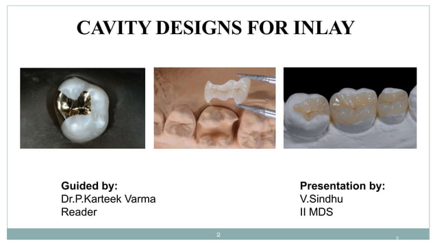 CAVITY DESIGNS FOR INLAY. | PPTX