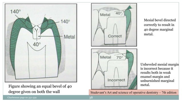 CAVITY DESIGNS FOR INLAY. | PPTX