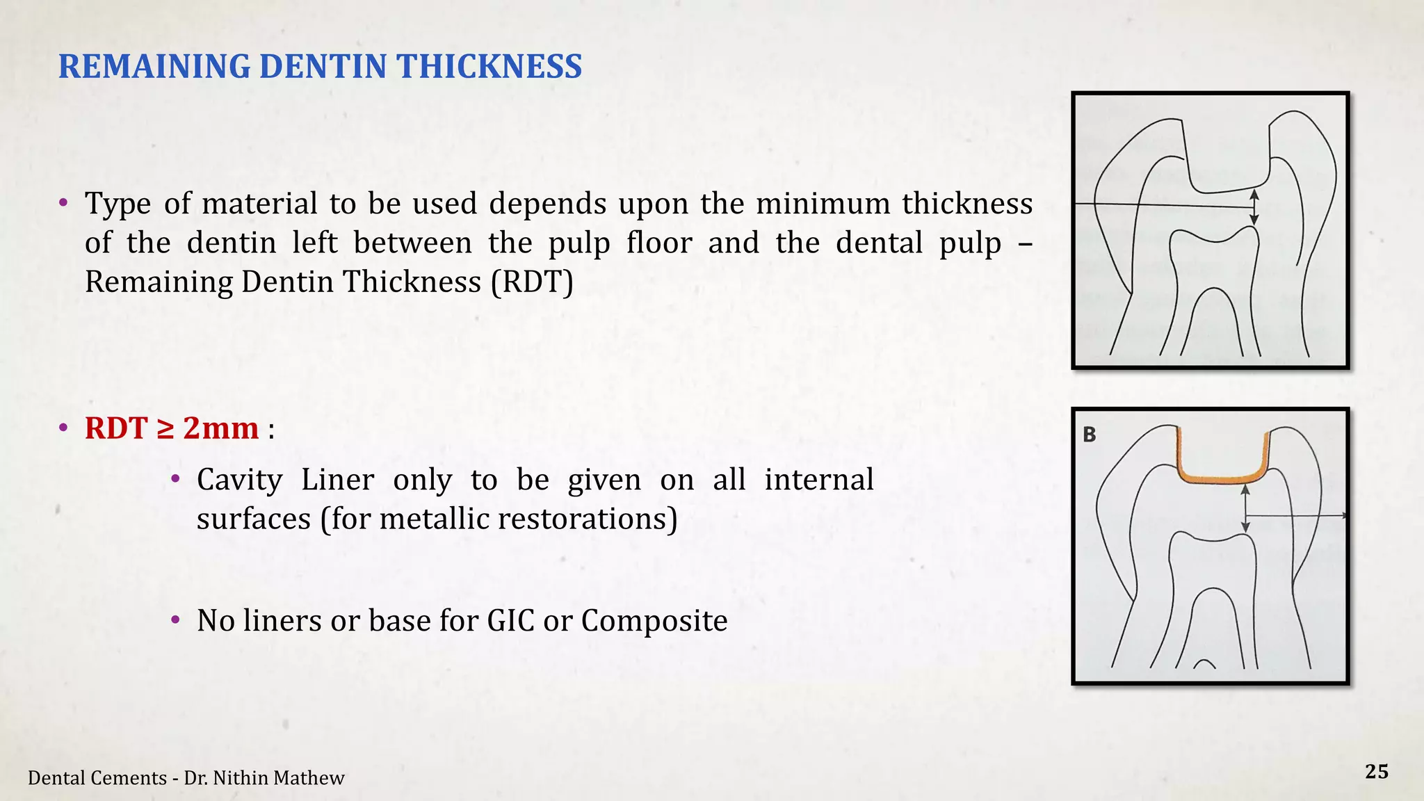 Dental Cements | PDF