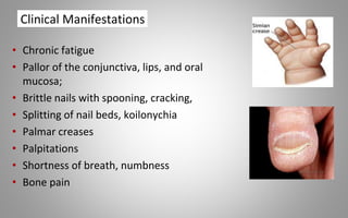 Clinical Manifestations
• Chronic fatigue
• Pallor of the conjunctiva, lips, and oral
mucosa;
• Brittle nails with spooning, cracking,
• Splitting of nail beds, koilonychia
• Palmar creases
• Palpitations
• Shortness of breath, numbness
• Bone pain
 
