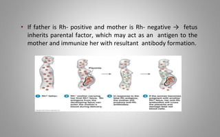 • If father is Rh- positive and mother is Rh- negative → fetus
inherits parental factor, which may act as an antigen to the
mother and immunize her with resultant antibody formation.
 