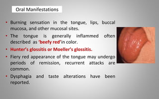Oral Manifestations
• Burning sensation in the tongue, lips, buccal
mucosa, and other mucosal sites.
• The tongue is generally inflammed often
described as ‘beefy red’in color.
• Hunter’s glossitis or Moeller’s glossitis.
• Fiery red appearance of the tongue may undergo
periods of remission, recurrent attacks are
common.
• Dysphagia and taste alterations have been
reported.
 