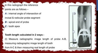 seminar 6 working length.pptx in detail all | PPTX