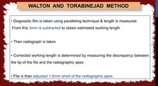seminar 6 working length.pptx in detail all | PPTX