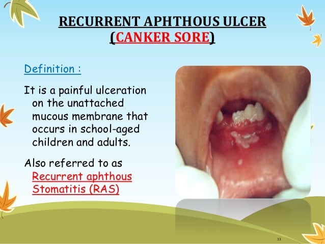 Gingival disease in childhood Gingival disease in childhood