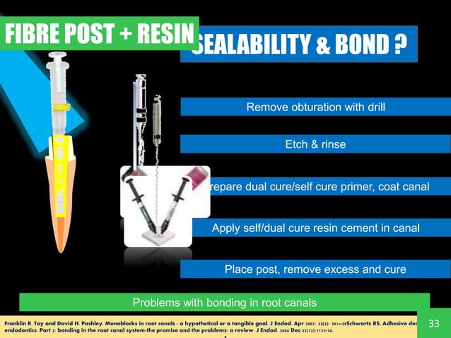 Monoblation Design MONOBLOC IN ENDODONTICS - Root canal filling materials and concept of ...