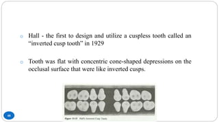Tooth Being Inverted Occlusion in Complete Denture | PPTX