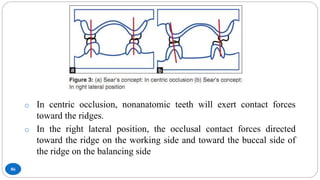 Occlusion in Complete Denture | PPTX