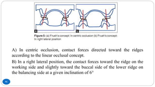 Occlusion in Complete Denture | PPTX