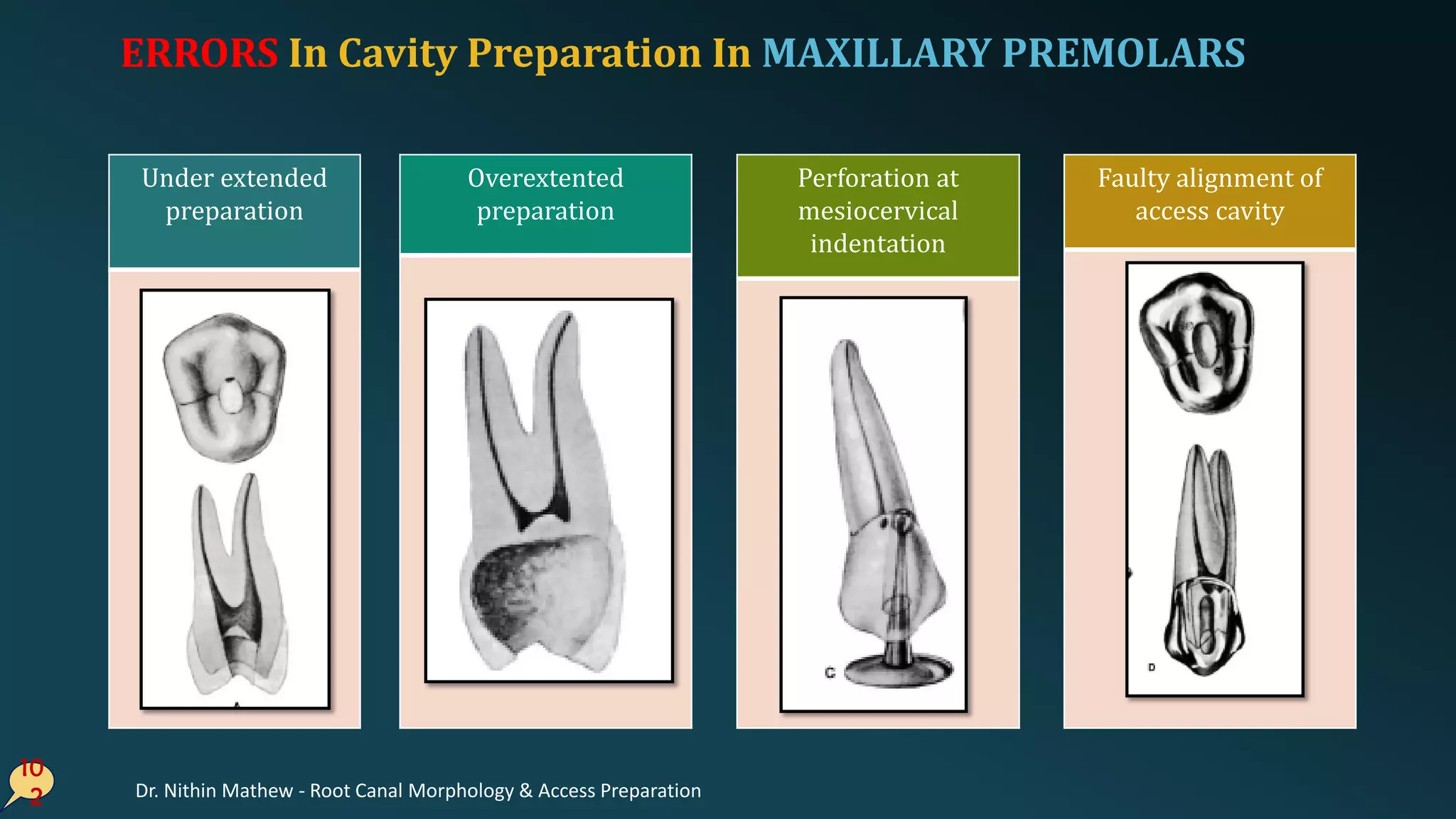 ERRORS In Cavity Preparation In MAXILLARY PREMOLARS
10
2
Under extended
preparation
Overextented
preparation
Faulty alignment of
access cavity
Perforation at
mesiocervical
indentation
Dr. Nithin Mathew - Root Canal Morphology & Access Preparation
 