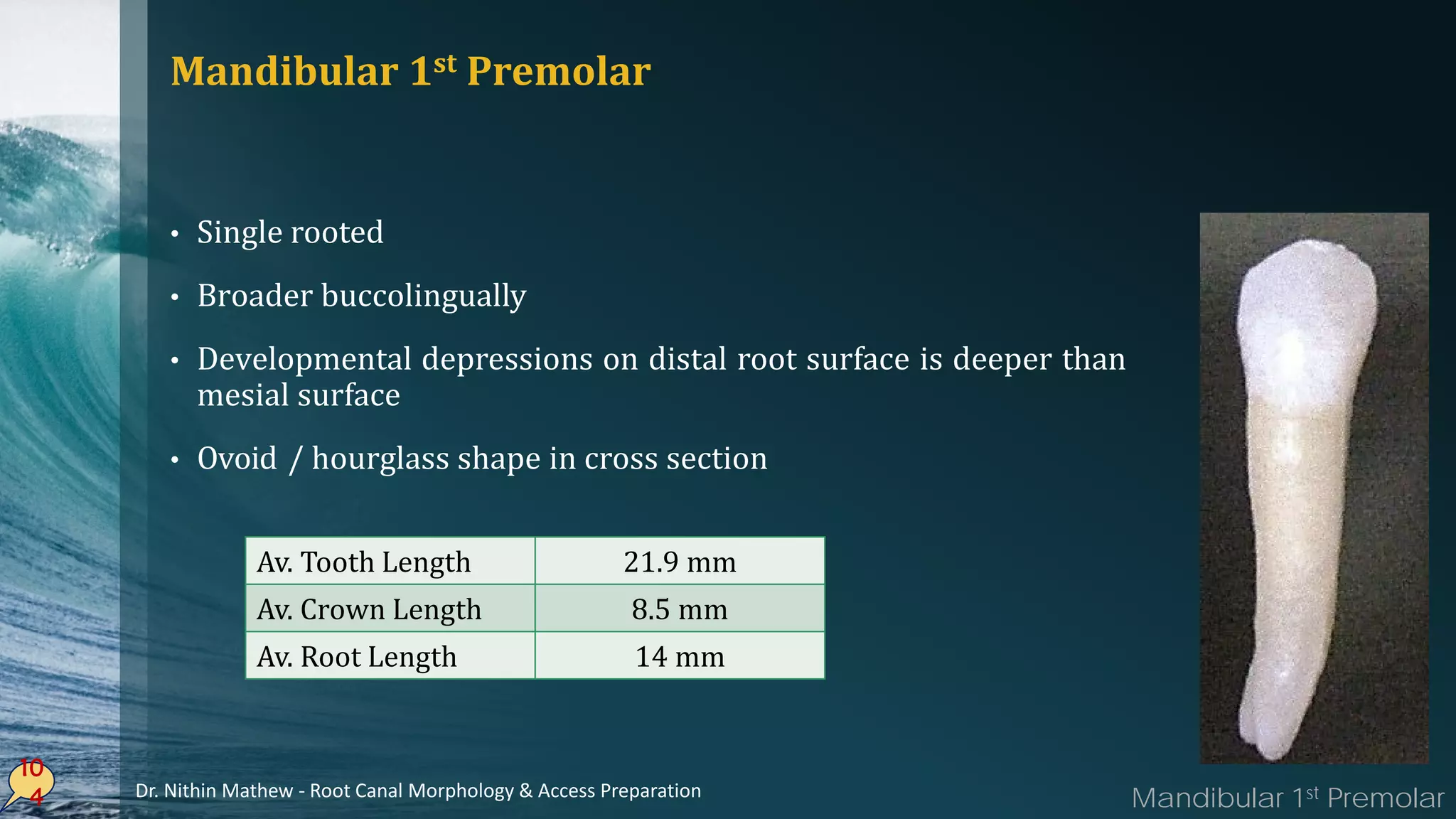 Mandibular 1st Premolar
• Single rooted
• Broader buccolingually
• Developmental depressions on distal root surface is deeper than
mesial surface
• Ovoid / hourglass shape in cross section
10
4
Av. Tooth Length 21.9 mm
Av. Crown Length 8.5 mm
Av. Root Length 14 mm
Mandibular 1st PremolarDr. Nithin Mathew - Root Canal Morphology & Access Preparation
 