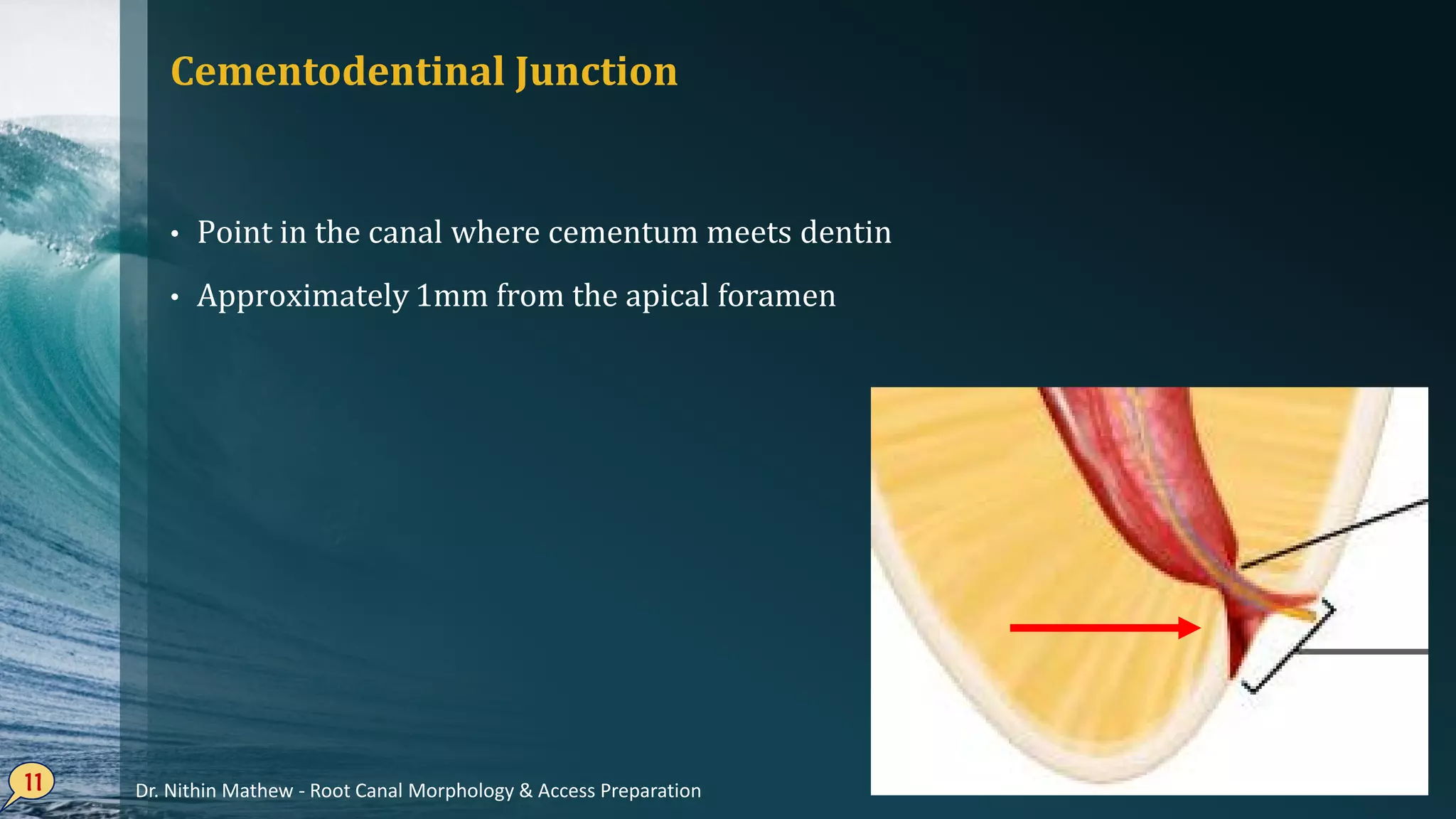 Cementodentinal Junction
• Point in the canal where cementum meets dentin
• Approximately 1mm from the apical foramen
11 Dr. Nithin Mathew - Root Canal Morphology & Access Preparation
 