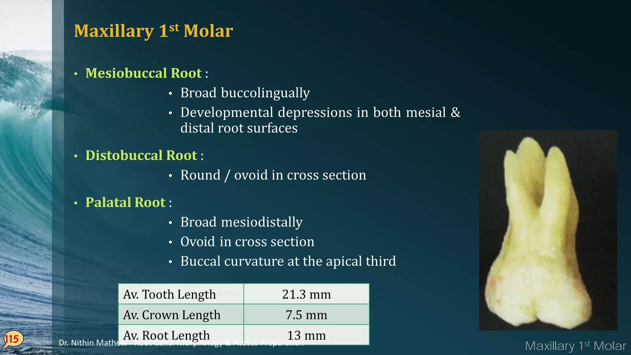 Maxillary 1st Molar
• Mesiobuccal Root :
• Broad buccolingually
• Developmental depressions in both mesial &
distal root surfaces
• Distobuccal Root :
• Round / ovoid in cross section
• Palatal Root :
• Broad mesiodistally
• Ovoid in cross section
• Buccal curvature at the apical third
115
Av. Tooth Length 21.3 mm
Av. Crown Length 7.5 mm
Av. Root Length 13 mm
Maxillary 1st MolarDr. Nithin Mathew - Root Canal Morphology & Access Preparation
 