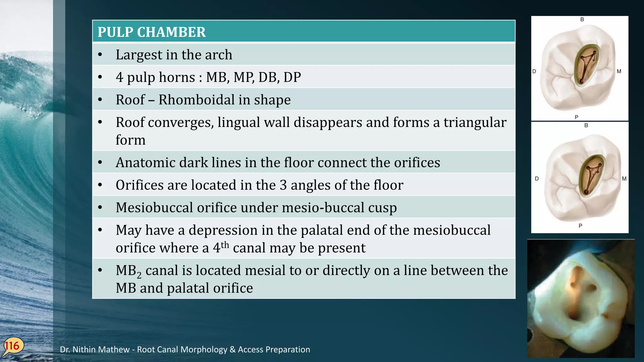 116
PULP CHAMBER
• Largest in the arch
• 4 pulp horns : MB, MP, DB, DP
• Roof – Rhomboidal in shape
• Roof converges, lingual wall disappears and forms a triangular
form
• Anatomic dark lines in the floor connect the orifices
• Orifices are located in the 3 angles of the floor
• Mesiobuccal orifice under mesio-buccal cusp
• May have a depression in the palatal end of the mesiobuccal
orifice where a 4th canal may be present
• MB2 canal is located mesial to or directly on a line between the
MB and palatal orifice
Dr. Nithin Mathew - Root Canal Morphology & Access Preparation
 