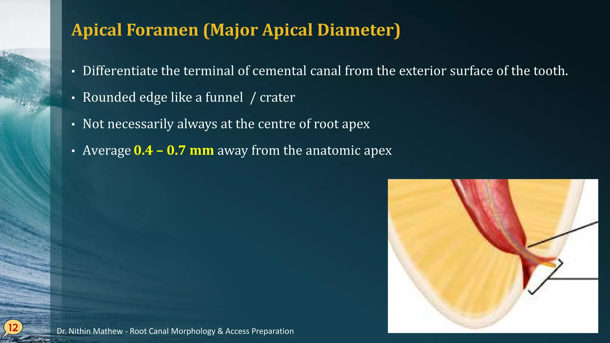 Apical Foramen (Major Apical Diameter)
• Differentiate the terminal of cemental canal from the exterior surface of the tooth.
• Rounded edge like a funnel / crater
• Not necessarily always at the centre of root apex
• Average 0.4 – 0.7 mm away from the anatomic apex
12 Dr. Nithin Mathew - Root Canal Morphology & Access Preparation
 