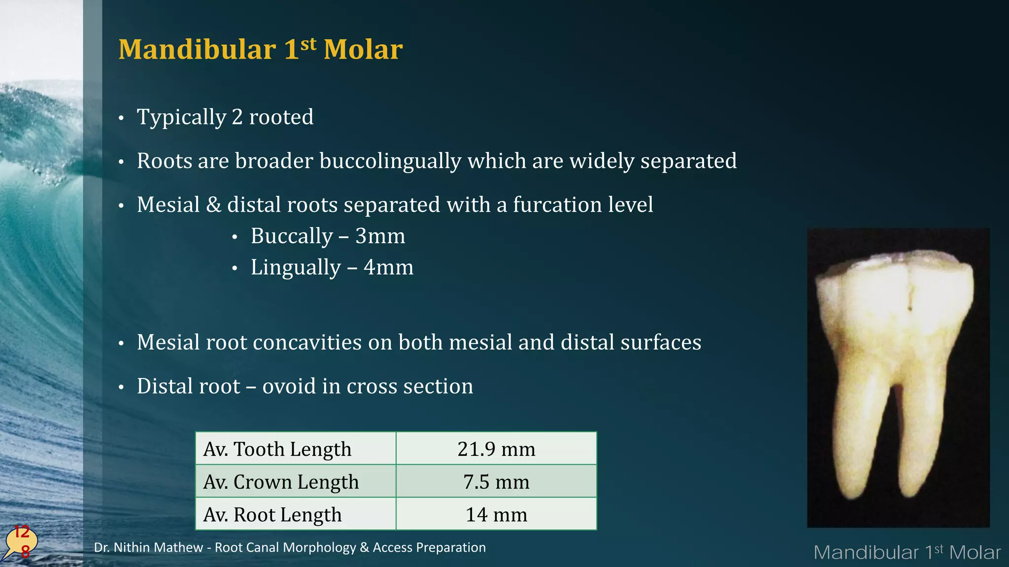 Mandibular 1st Molar
• Typically 2 rooted
• Roots are broader buccolingually which are widely separated
• Mesial & distal roots separated with a furcation level
• Buccally – 3mm
• Lingually – 4mm
• Mesial root concavities on both mesial and distal surfaces
• Distal root – ovoid in cross section
12
8
Av. Tooth Length 21.9 mm
Av. Crown Length 7.5 mm
Av. Root Length 14 mm
Mandibular 1st MolarDr. Nithin Mathew - Root Canal Morphology & Access Preparation
 