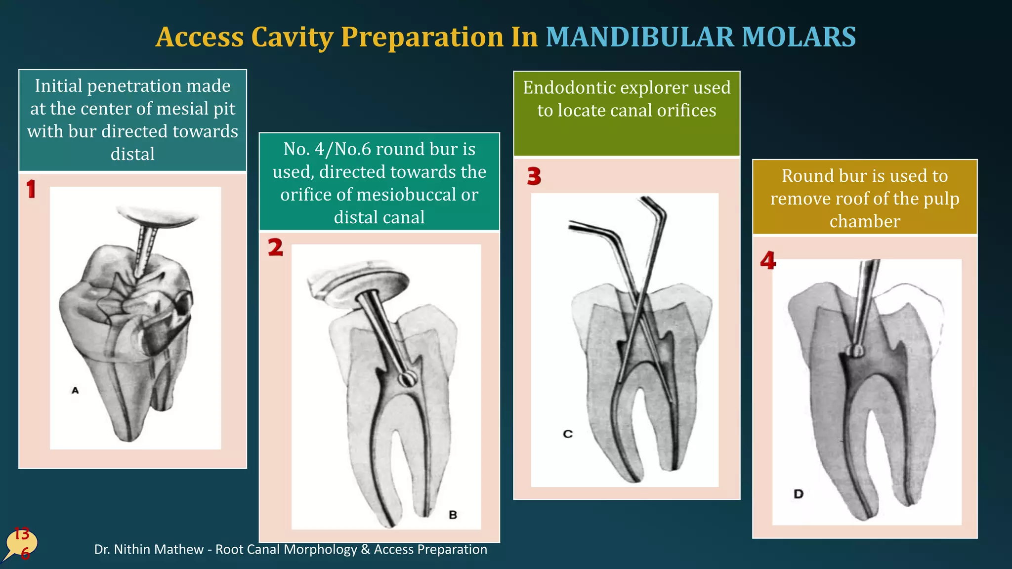 Access Cavity Preparation In MANDIBULAR MOLARS
13
6
Initial penetration made
at the center of mesial pit
with bur directed towards
distal No. 4/No.6 round bur is
used, directed towards the
orifice of mesiobuccal or
distal canal
Endodontic explorer used
to locate canal orifices
Round bur is used to
remove roof of the pulp
chamber
Dr. Nithin Mathew - Root Canal Morphology & Access Preparation
 