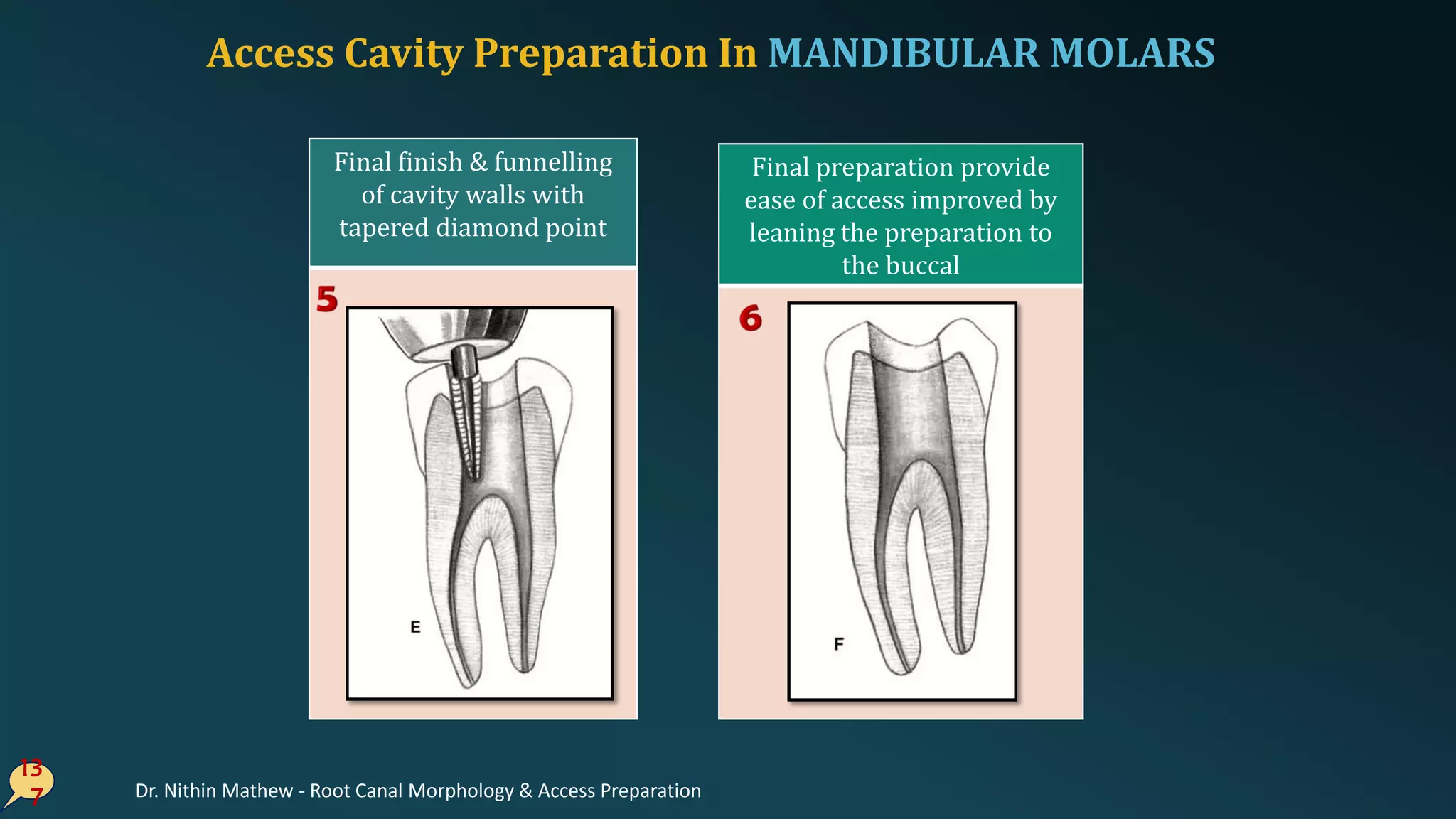 13
7
Final finish & funnelling
of cavity walls with
tapered diamond point
Final preparation provide
ease of access improved by
leaning the preparation to
the buccal
Access Cavity Preparation In MANDIBULAR MOLARS
Dr. Nithin Mathew - Root Canal Morphology & Access Preparation
 