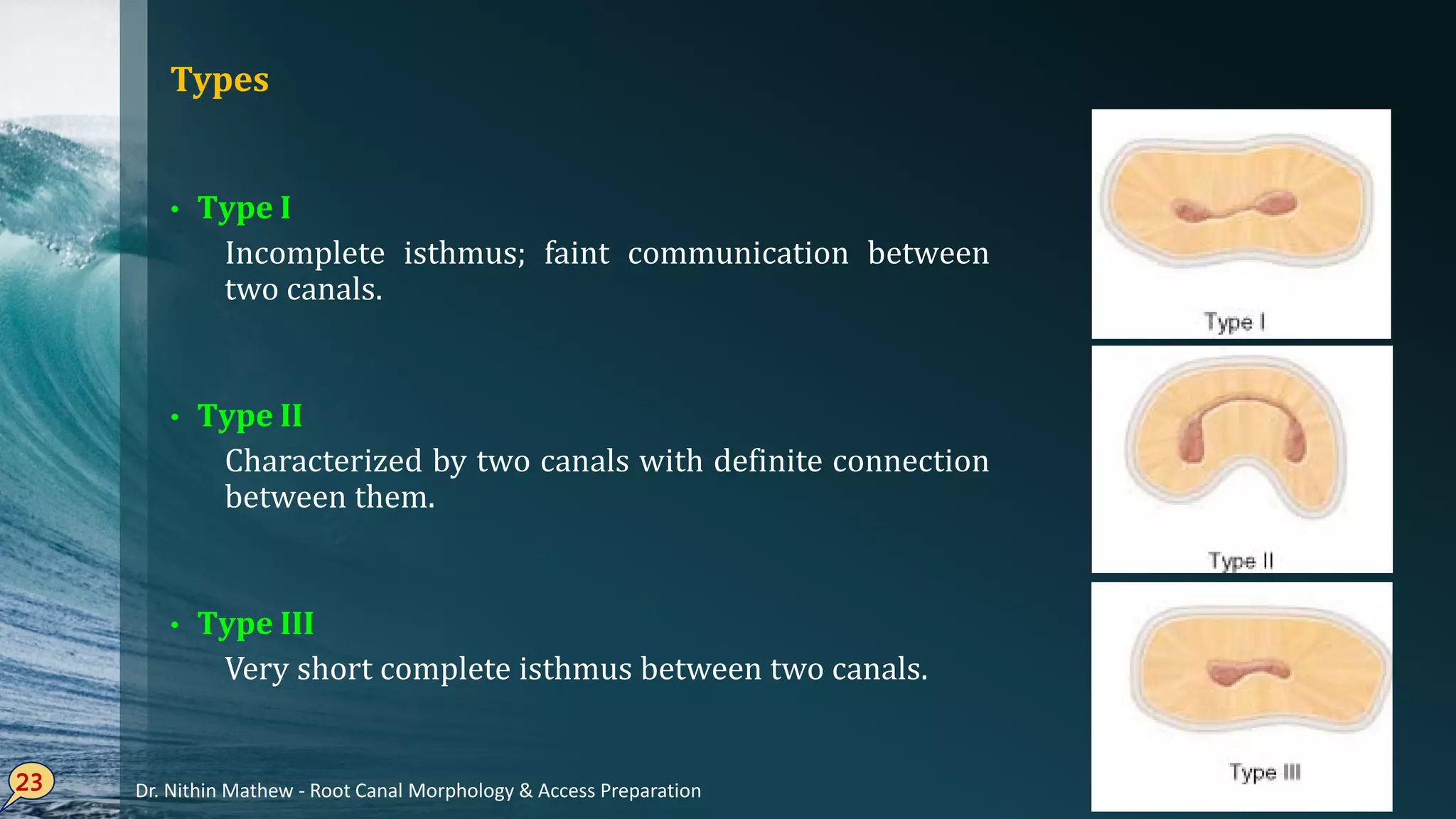 Types
• Type I
Incomplete isthmus; faint communication between
two canals.
• Type II
Characterized by two canals with definite connection
between them.
• Type III
Very short complete isthmus between two canals.
23 Dr. Nithin Mathew - Root Canal Morphology & Access Preparation
 