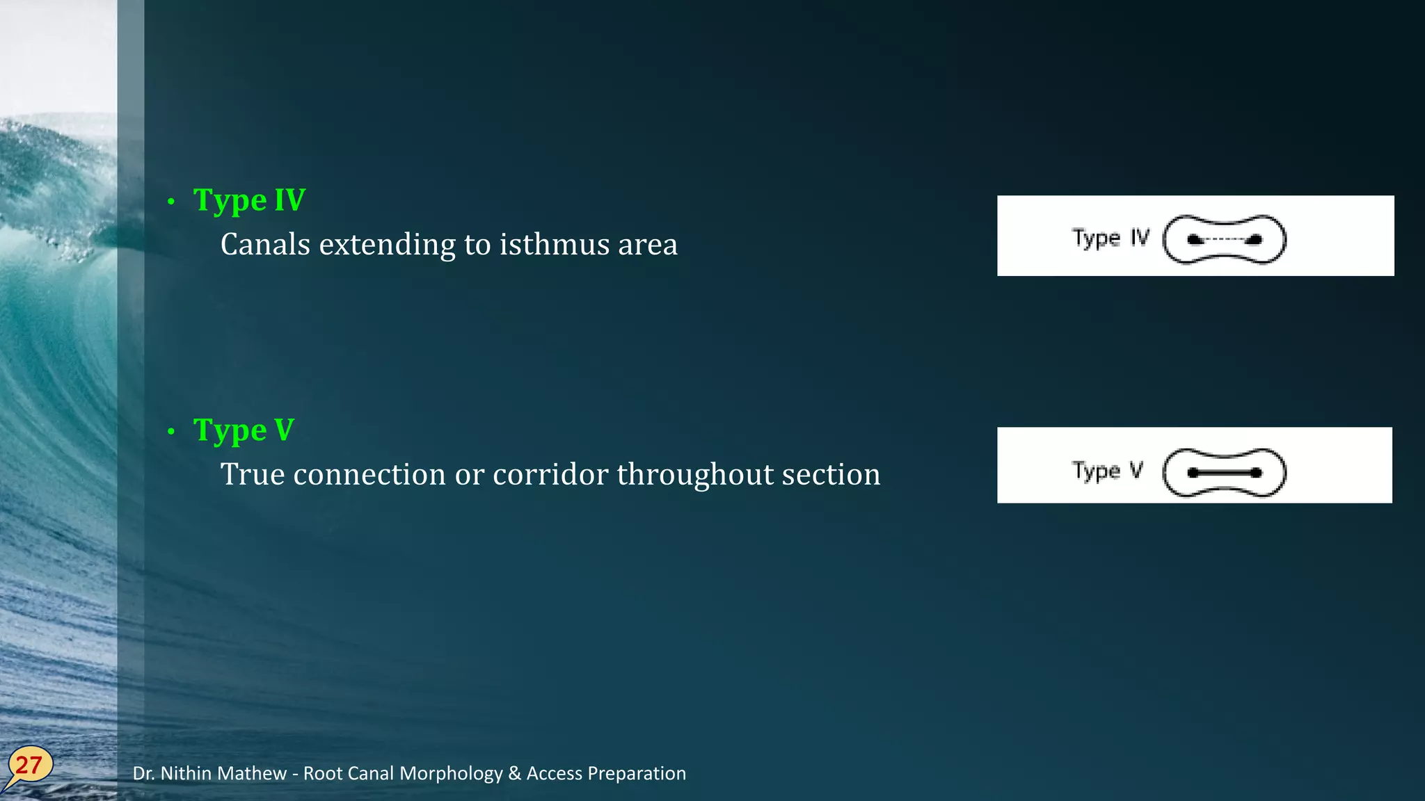 • Type IV
Canals extending to isthmus area
• Type V
True connection or corridor throughout section
27 Dr. Nithin Mathew - Root Canal Morphology & Access Preparation
 