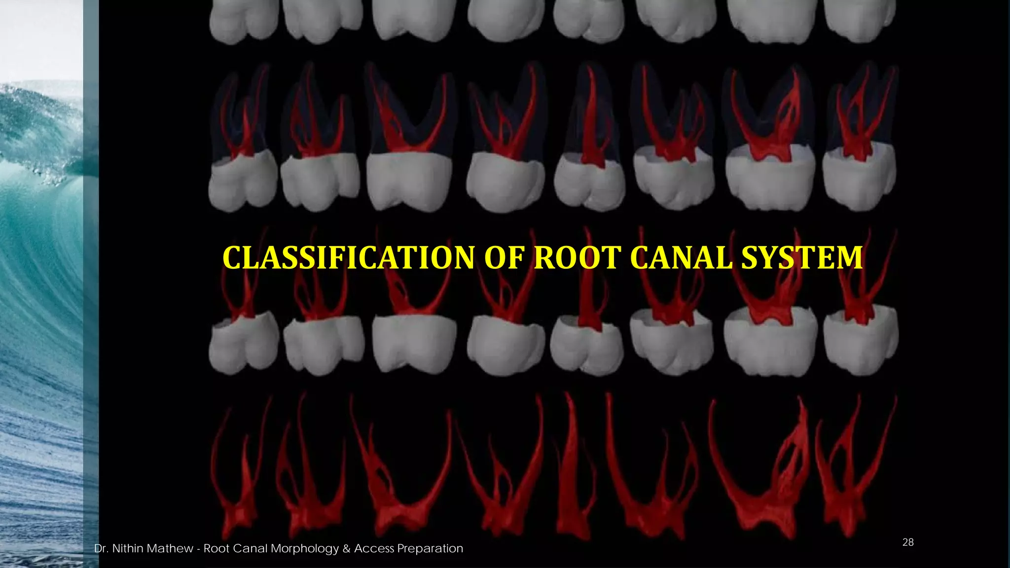 CLASSIFICATION OF ROOT CANAL SYSTEM
Dr. Nithin Mathew - Root Canal Morphology & Access Preparation
28
 