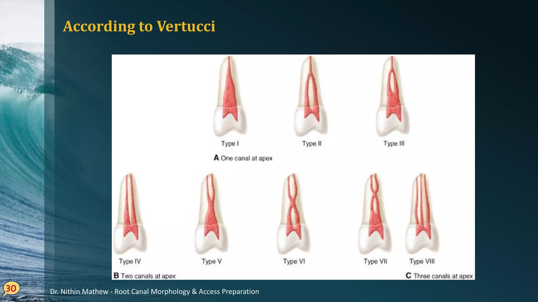 According to Vertucci
30 Dr. Nithin Mathew - Root Canal Morphology & Access Preparation
 