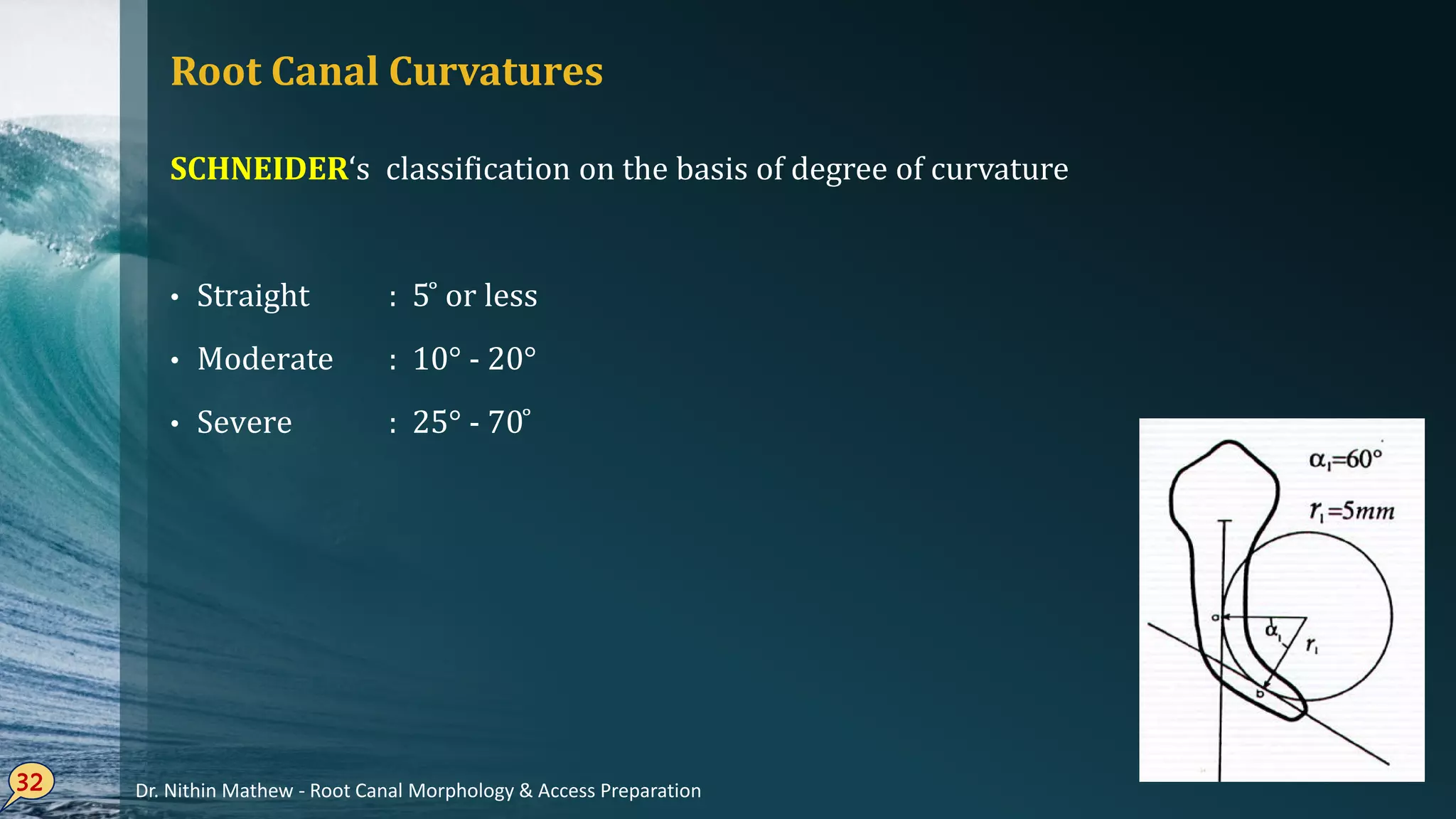 Root Canal Curvatures
SCHNEIDER‘s classification on the basis of degree of curvature
Straight• : 5 ̊ or less
Moderate• : 10° - 20°
Severe• : 25° - 70 ̊
32 Dr. Nithin Mathew - Root Canal Morphology & Access Preparation
 