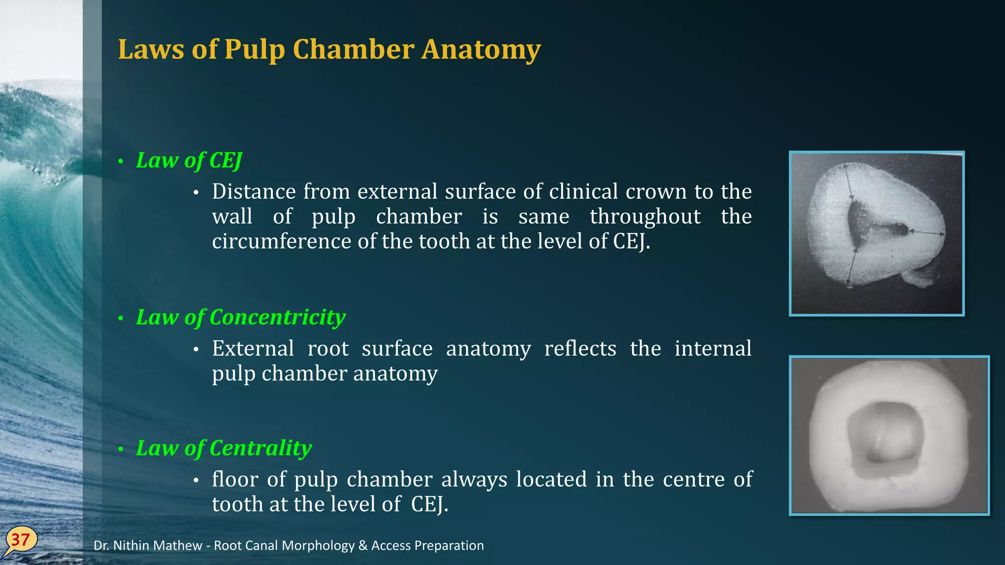 Laws of Pulp Chamber Anatomy
• Law of CEJ
• Distance from external surface of clinical crown to the
wall of pulp chamber is same throughout the
circumference of the tooth at the level of CEJ.
37
Law• of Concentricity
External• root surface anatomy reflects the internal
pulp chamber anatomy
Law• of Centrality
floor• of pulp chamber always located in the centre of
tooth at the level of CEJ.
Dr. Nithin Mathew - Root Canal Morphology & Access Preparation
 