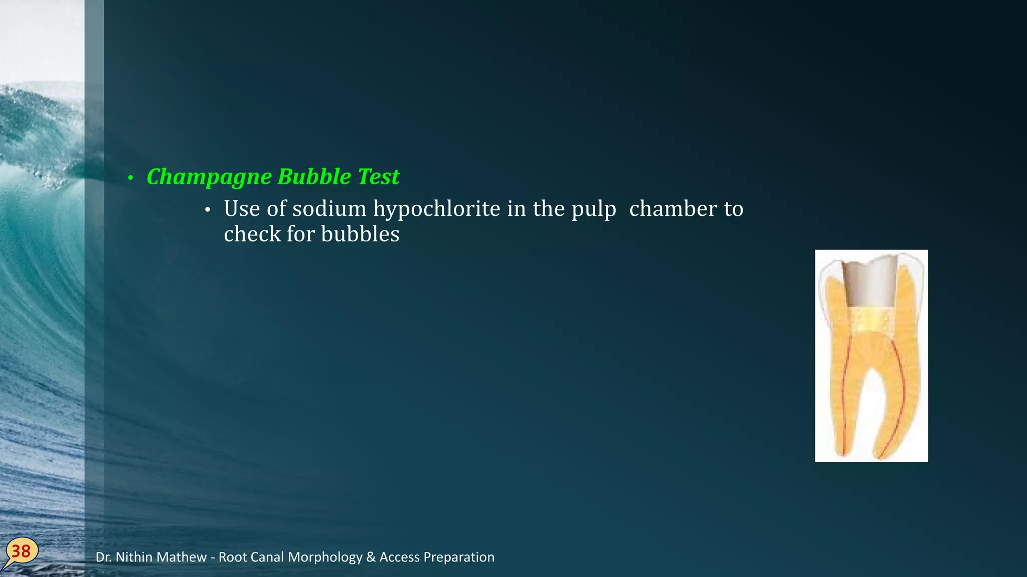 • Champagne Bubble Test
• Use of sodium hypochlorite in the pulp chamber to
check for bubbles
38 Dr. Nithin Mathew - Root Canal Morphology & Access Preparation
 