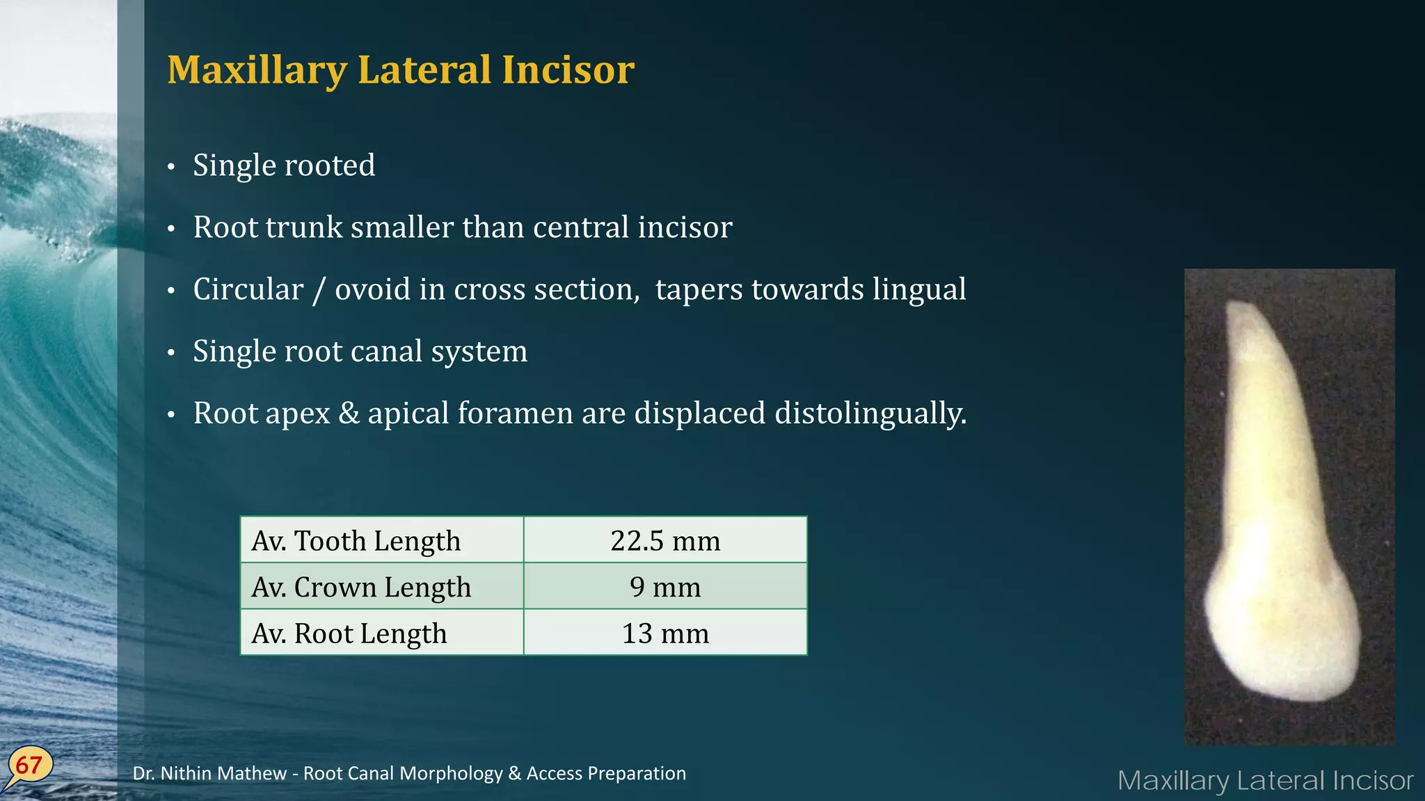 Maxillary Lateral Incisor
• Single rooted
• Root trunk smaller than central incisor
• Circular / ovoid in cross section, tapers towards lingual
• Single root canal system
• Root apex & apical foramen are displaced distolingually.
67
Av. Tooth Length 22.5 mm
Av. Crown Length 9 mm
Av. Root Length 13 mm
Maxillary Lateral IncisorDr. Nithin Mathew - Root Canal Morphology & Access Preparation
 