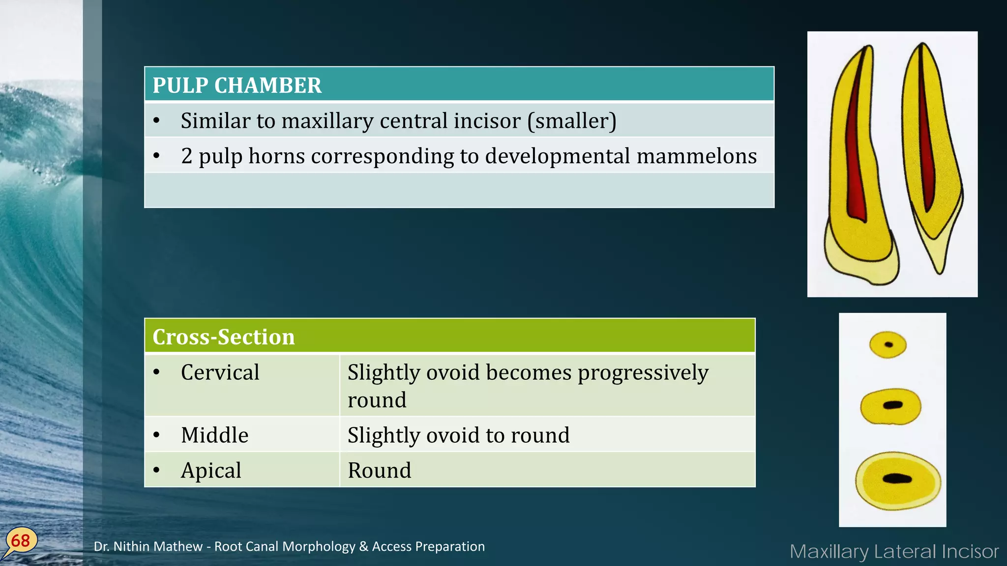 68
PULP CHAMBER
• Similar to maxillary central incisor (smaller)
• 2 pulp horns corresponding to developmental mammelons
Cross-Section
• Cervical Slightly ovoid becomes progressively
round
• Middle Slightly ovoid to round
• Apical Round
Maxillary Lateral IncisorDr. Nithin Mathew - Root Canal Morphology & Access Preparation
 