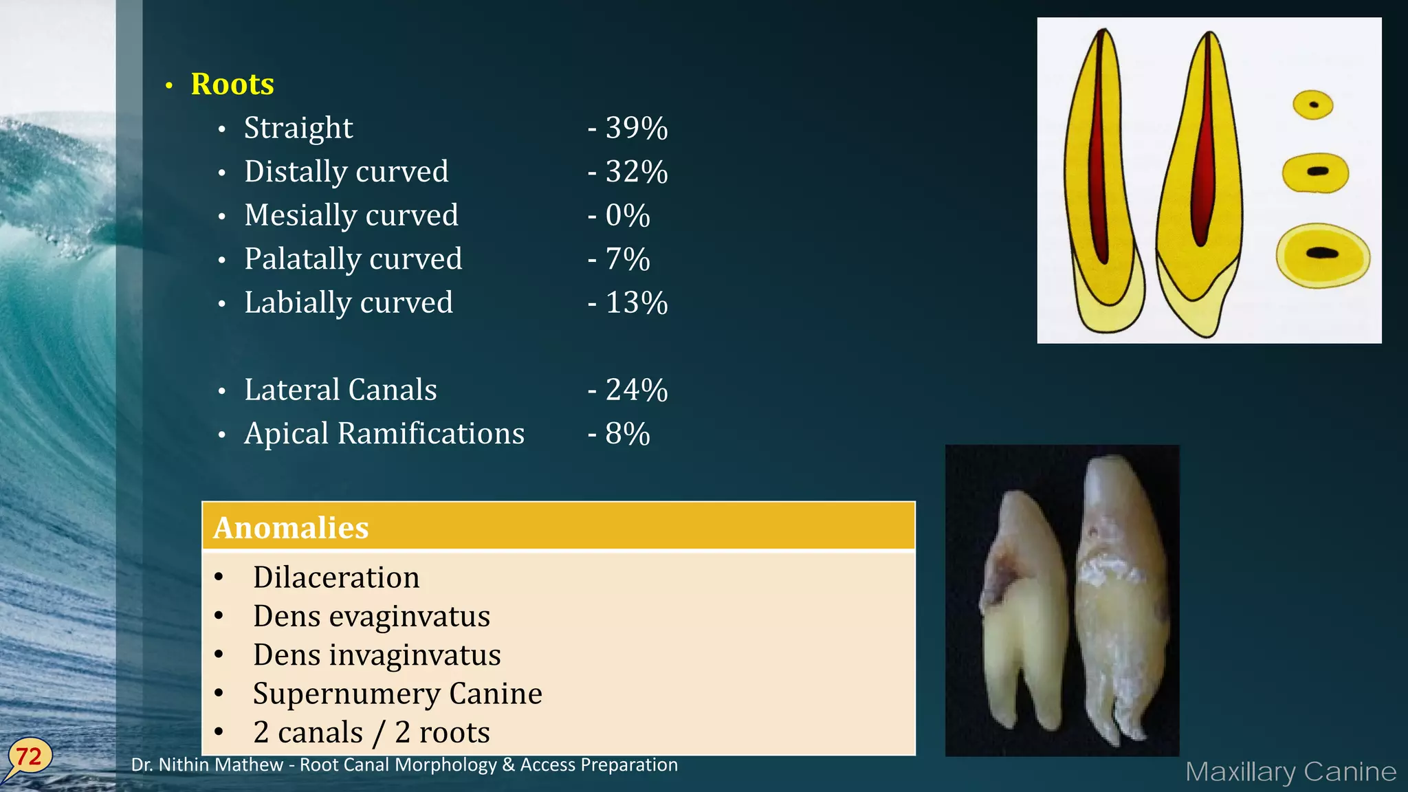 • Roots
• Straight - 39%
• Distally curved - 32%
• Mesially curved - 0%
• Palatally curved - 7%
• Labially curved - 13%
• Lateral Canals - 24%
• Apical Ramifications - 8%
72
Anomalies
• Dilaceration
• Dens evaginvatus
• Dens invaginvatus
• Supernumery Canine
• 2 canals / 2 roots
Maxillary CanineDr. Nithin Mathew - Root Canal Morphology & Access Preparation
 