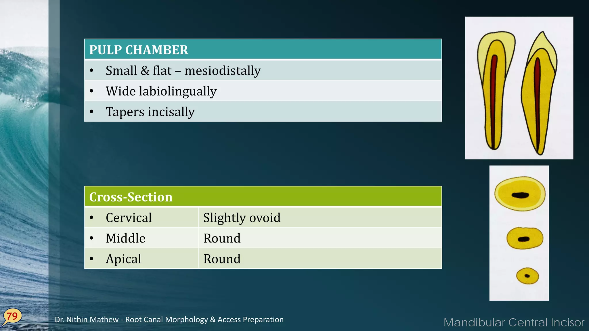 79
PULP CHAMBER
• Small & flat – mesiodistally
• Wide labiolingually
• Tapers incisally
Cross-Section
• Cervical Slightly ovoid
• Middle Round
• Apical Round
Mandibular Central IncisorDr. Nithin Mathew - Root Canal Morphology & Access Preparation
 