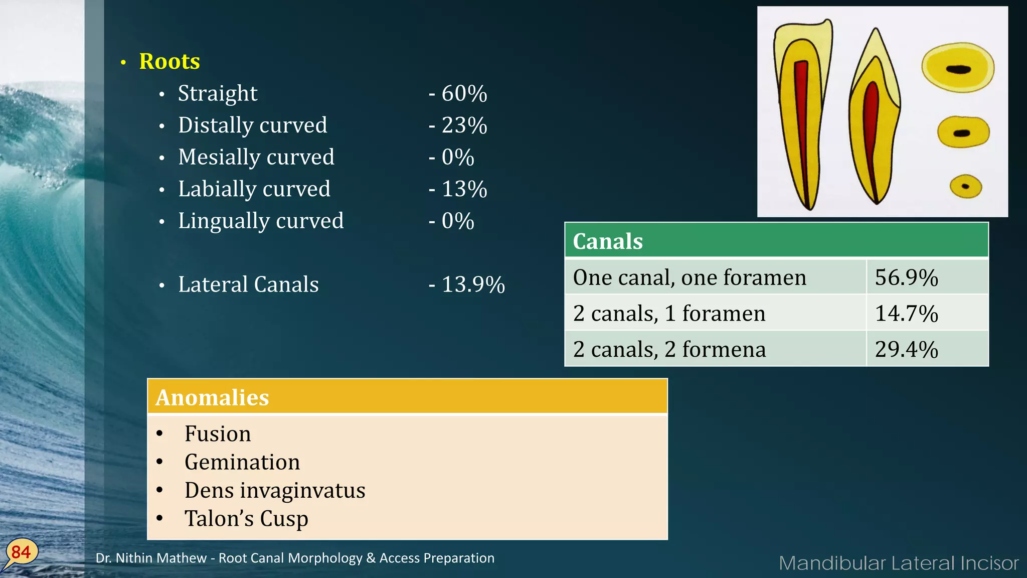 • Roots
• Straight - 60%
• Distally curved - 23%
• Mesially curved - 0%
• Labially curved - 13%
• Lingually curved - 0%
• Lateral Canals - 13.9%
84
Anomalies
• Fusion
• Gemination
• Dens invaginvatus
• Talon’s Cusp
Canals
One canal, one foramen 56.9%
2 canals, 1 foramen 14.7%
2 canals, 2 formena 29.4%
Mandibular Lateral IncisorDr. Nithin Mathew - Root Canal Morphology & Access Preparation
 