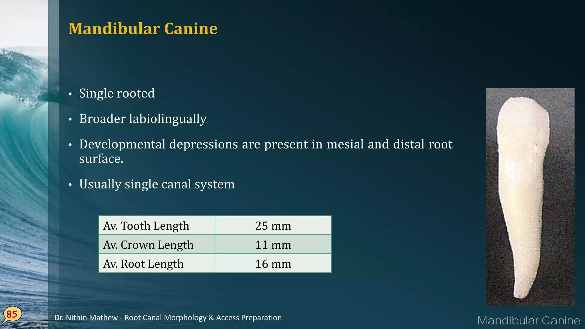 Mandibular Canine
Single• rooted
Broader• labiolingually
Developmental• depressions are present in mesial and distal root
surface.
Usually• single canal system
85
Av. Tooth Length 25 mm
Av. Crown Length 11 mm
Av. Root Length 16 mm
Mandibular CanineDr. Nithin Mathew - Root Canal Morphology & Access Preparation
 
