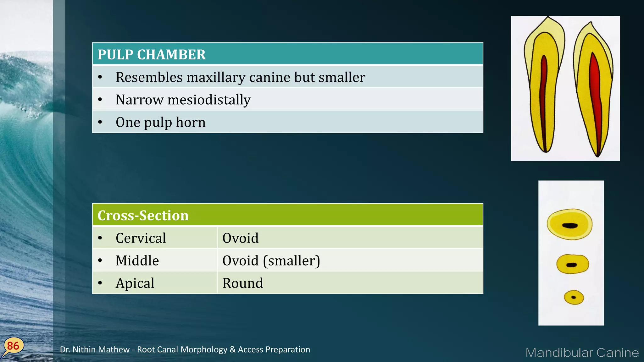 86
PULP CHAMBER
• Resembles maxillary canine but smaller
• Narrow mesiodistally
• One pulp horn
Cross-Section
• Cervical Ovoid
• Middle Ovoid (smaller)
• Apical Round
Mandibular CanineDr. Nithin Mathew - Root Canal Morphology & Access Preparation
 