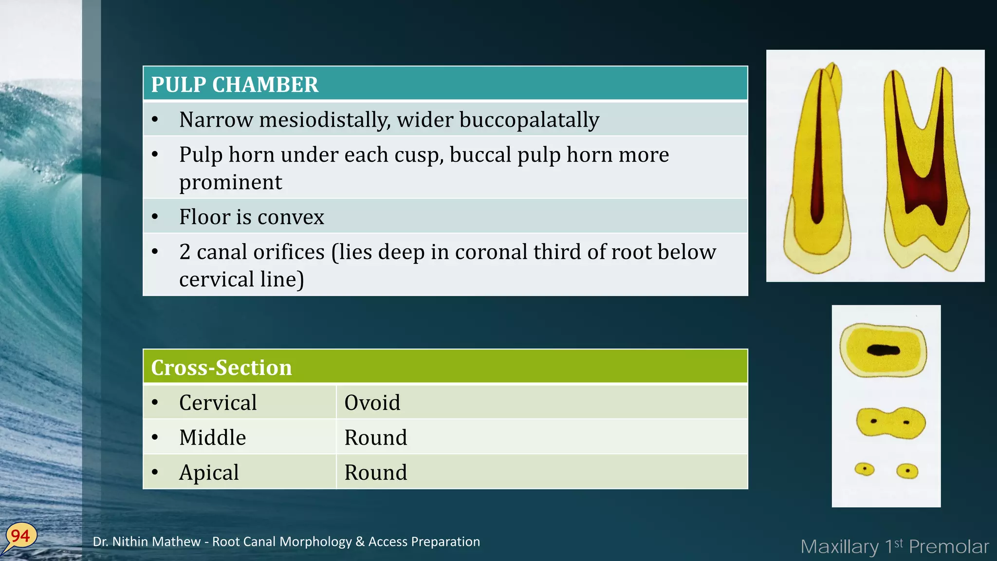 94
PULP CHAMBER
• Narrow mesiodistally, wider buccopalatally
• Pulp horn under each cusp, buccal pulp horn more
prominent
• Floor is convex
• 2 canal orifices (lies deep in coronal third of root below
cervical line)
Cross-Section
• Cervical Ovoid
• Middle Round
• Apical Round
Maxillary 1st PremolarDr. Nithin Mathew - Root Canal Morphology & Access Preparation
 