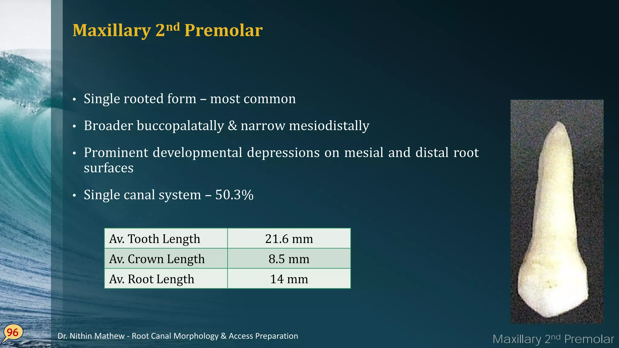 Maxillary 2nd Premolar
Single• rooted form – most common
Broader• buccopalatally & narrow mesiodistally
Prominent• developmental depressions on mesial and distal root
surfaces
Single• canal system – 50.3%
96
Av. Tooth Length 21.6 mm
Av. Crown Length 8.5 mm
Av. Root Length 14 mm
Maxillary 2nd PremolarDr. Nithin Mathew - Root Canal Morphology & Access Preparation
 
