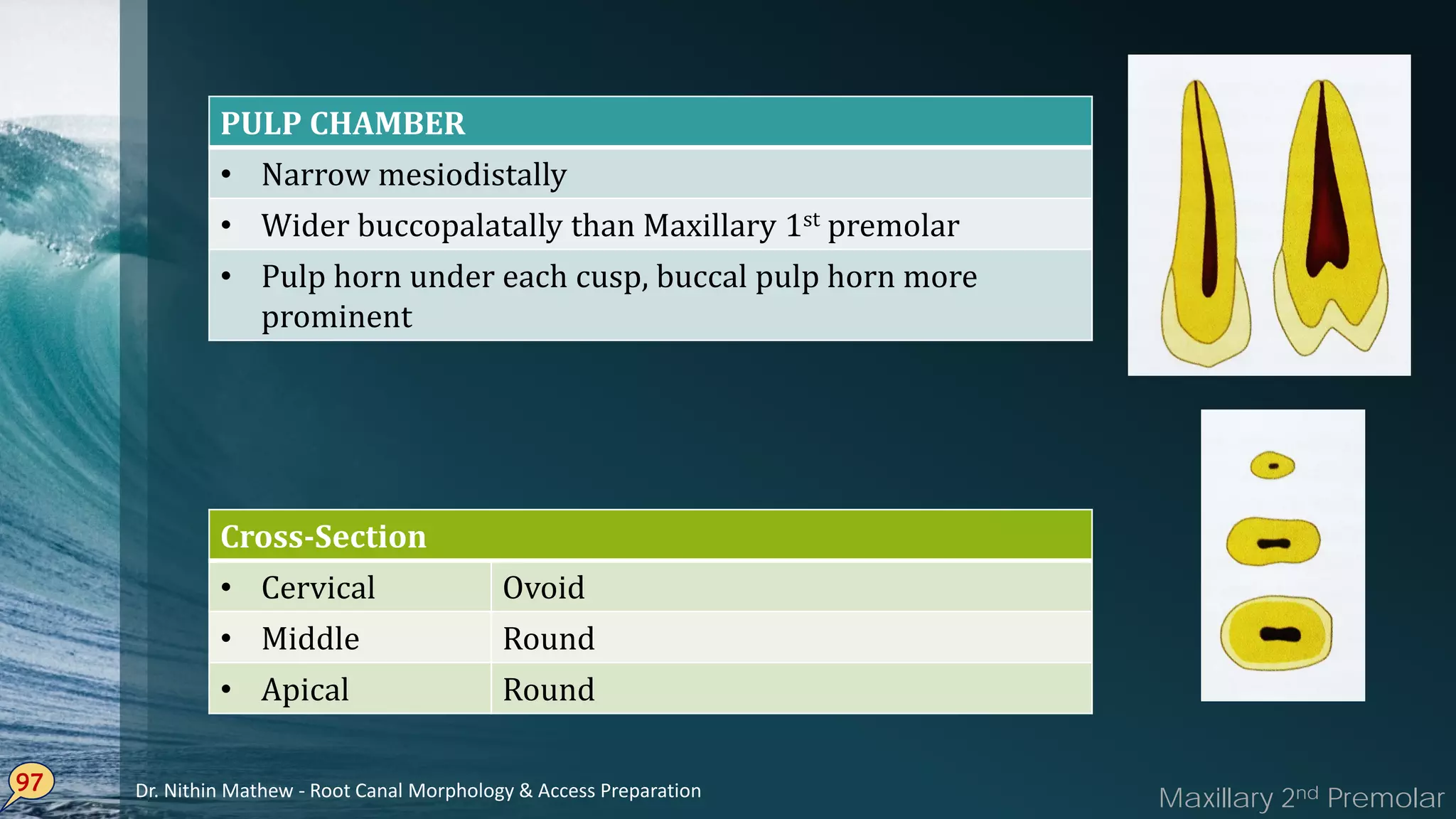 97
PULP CHAMBER
• Narrow mesiodistally
• Wider buccopalatally than Maxillary 1st premolar
• Pulp horn under each cusp, buccal pulp horn more
prominent
Cross-Section
• Cervical Ovoid
• Middle Round
• Apical Round
Maxillary 2nd PremolarDr. Nithin Mathew - Root Canal Morphology & Access Preparation
 