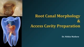 Mathew Root Root Canal Morphology & Access Preparation | PDF