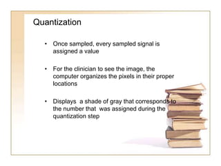 Quantization Radiology Image receptors in Dentistry | PPTX