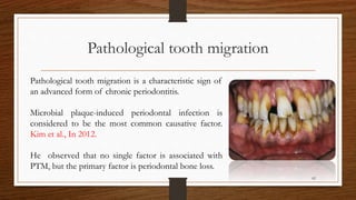Pathological tooth migration
82
Pathological tooth migration is a characteristic sign of
an advanced form of chronic periodontitis.
Microbial plaque-induced periodontal infection is
considered to be the most common causative factor.
Kim et al., In 2012.
He observed that no single factor is associated with
PTM, but the primary factor is periodontal bone loss.
 