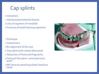 Cap splints
• Indications
 Advanced periodontal disease
Loss of segment of mandible
Fractures of tooth bearing segments
• Technique
 Impressions
Re-alignment of the cast
 Cap splint (with cleats) fabricated
 Reduction of fractured fragments
Fitting of the splint- cemented onto
teeth
IMF done by attaching elastic bands to
cleats
 