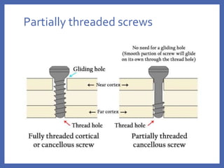 Partially threaded screws
 