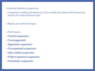 • Internal skeleton suspension
 Suspend a mobile part below to a firm stable part above the fracture by
means of a subcutaneous wire
Rapid, accurate technique
Techniques :
• Frontal suspension :
• Cicumzygomatic
• Zygomatic suspension
• Circumpalatal suspension
• Infra-orbital suspension
• Piriform aperture suspension
• Peralveolar suspension
 