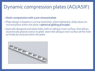 Dynamic compression plates (AO/ASIF)
• Static compression with a pre-stressed plate
• Plate design is based on a screw head that, when tightened, slides down an
inclined plane within the plate ( spherical gliding principle)
• Specially designed oval plate holes with an oblique inner surface, that allows
eccentrically placed screws to glide down the oblique inner surface of the hole
to finally be centred within the plate
 
