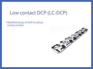 Low contact DCP (LC-DCP)
• Modified design of DCP to reduce
contact surface
 