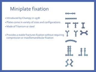 fixation systems in maxillofacial fractures | PPT