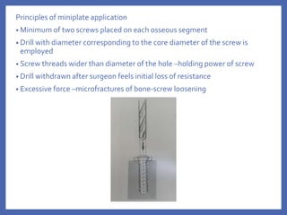 Principles of miniplate application
• Minimum of two screws placed on each osseous segment
• Drill with diameter corresponding to the core diameter of the screw is
employed
• Screw threads wider than diameter of the hole –holding power of screw
• Drill withdrawn after surgeon feels initial loss of resistance
• Excessive force –microfractures of bone-screw loosening
 