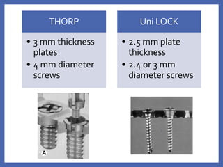 THORP
• 3 mm thickness
plates
• 4 mm diameter
screws
Uni LOCK
• 2.5 mm plate
thickness
• 2.4 or 3 mm
diameter screws
 